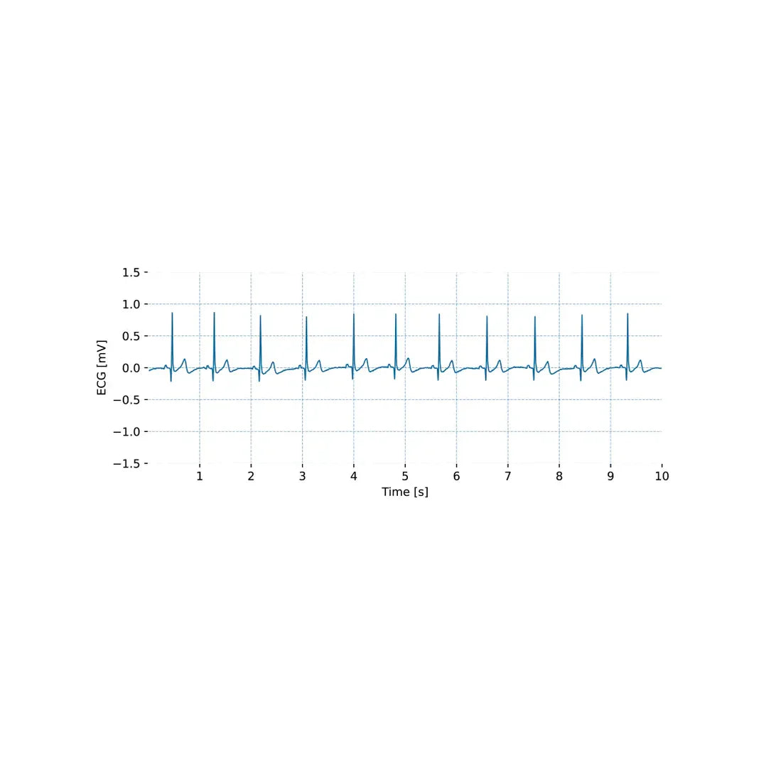 Biosignalsplux EKG-Sensorkabel 3 x 30 cm